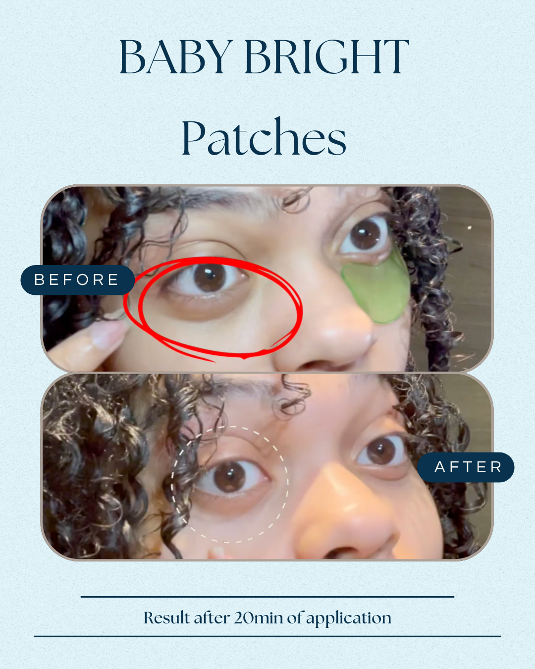 BABY BRIGHT - Aloe Vera & Fresh Collagen Eyes Mask